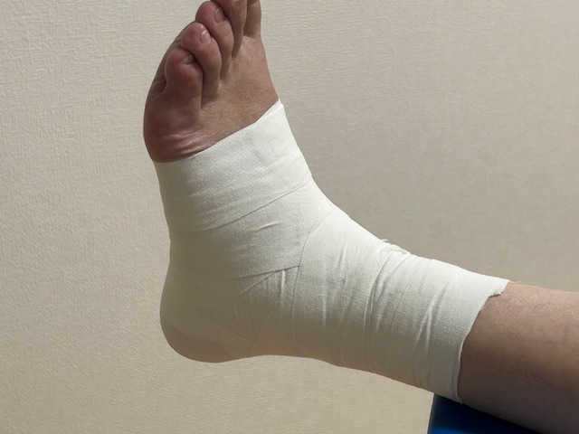 整形外科疾患等